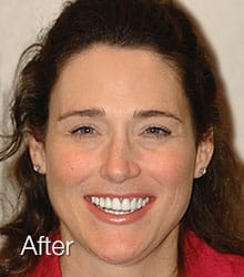 Cecilia Lumineers after photo.