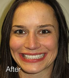 Jaclynn Lumineers after photo.