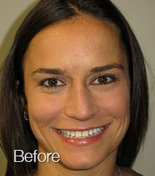 Jaclynn Lumineers before photo.