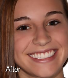 madison Lumineers after photo.